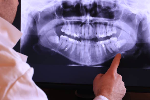 Best Emergency Dental Care for Broken or Chipped Teeth in Olympia, WA