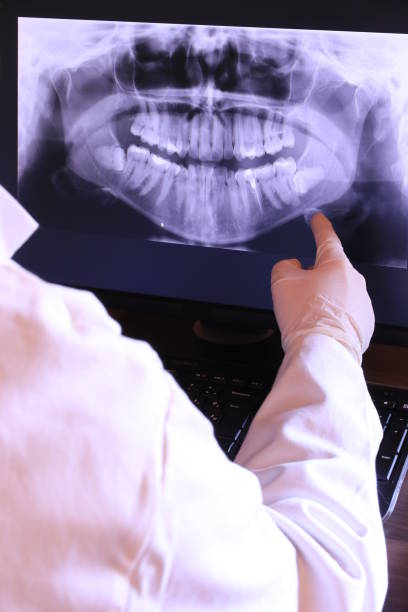 Best Emergency Gum Treatment in Olympia, WA